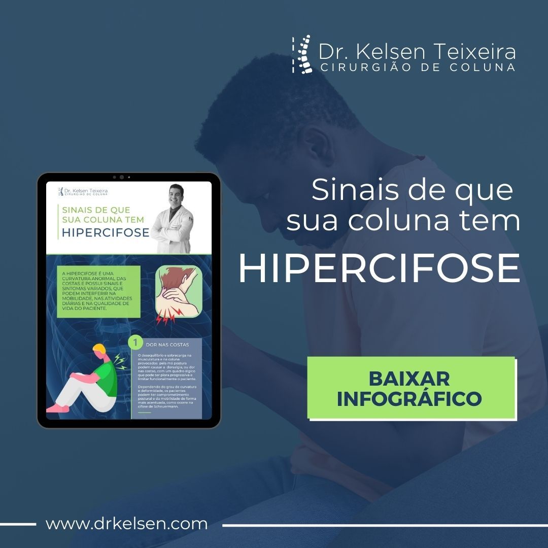 Hipercifose