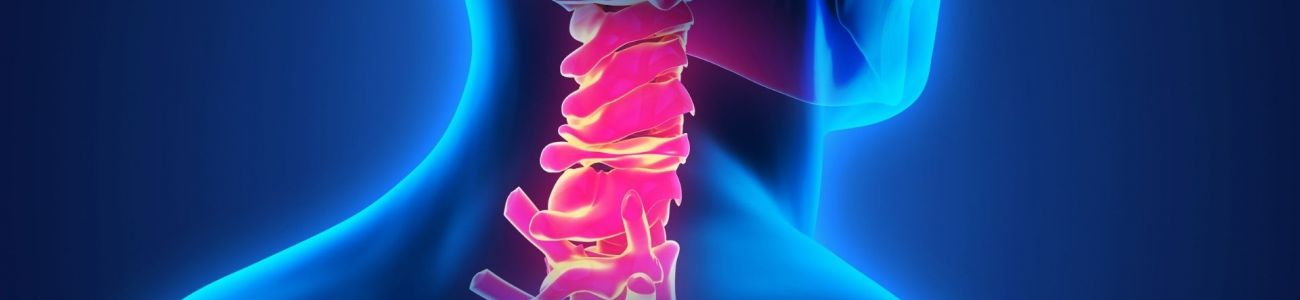 hernia-cervical